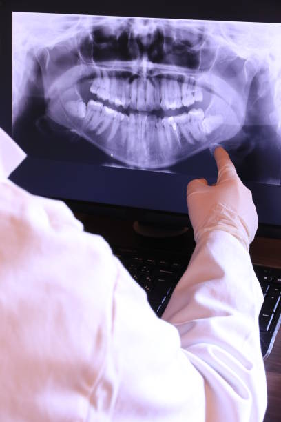 Tooth Infection Emergency Dentist in IL
